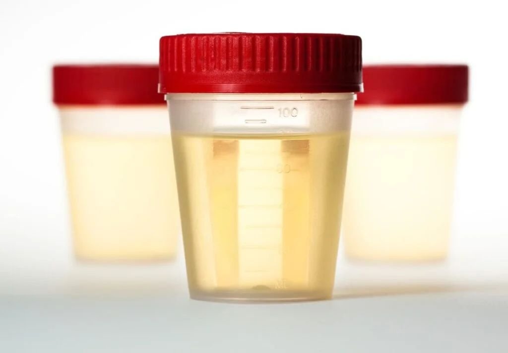 a2143d23fabbcc531fd2a2f155825220